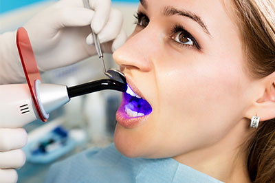 Holley Dental Care | Root Canals, Veneers and Dental Fillings